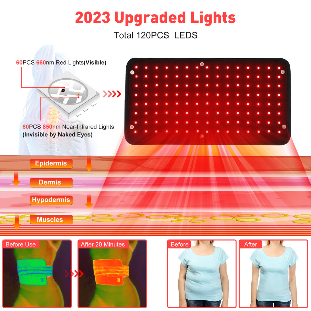 NovaSkin ThermaBelt