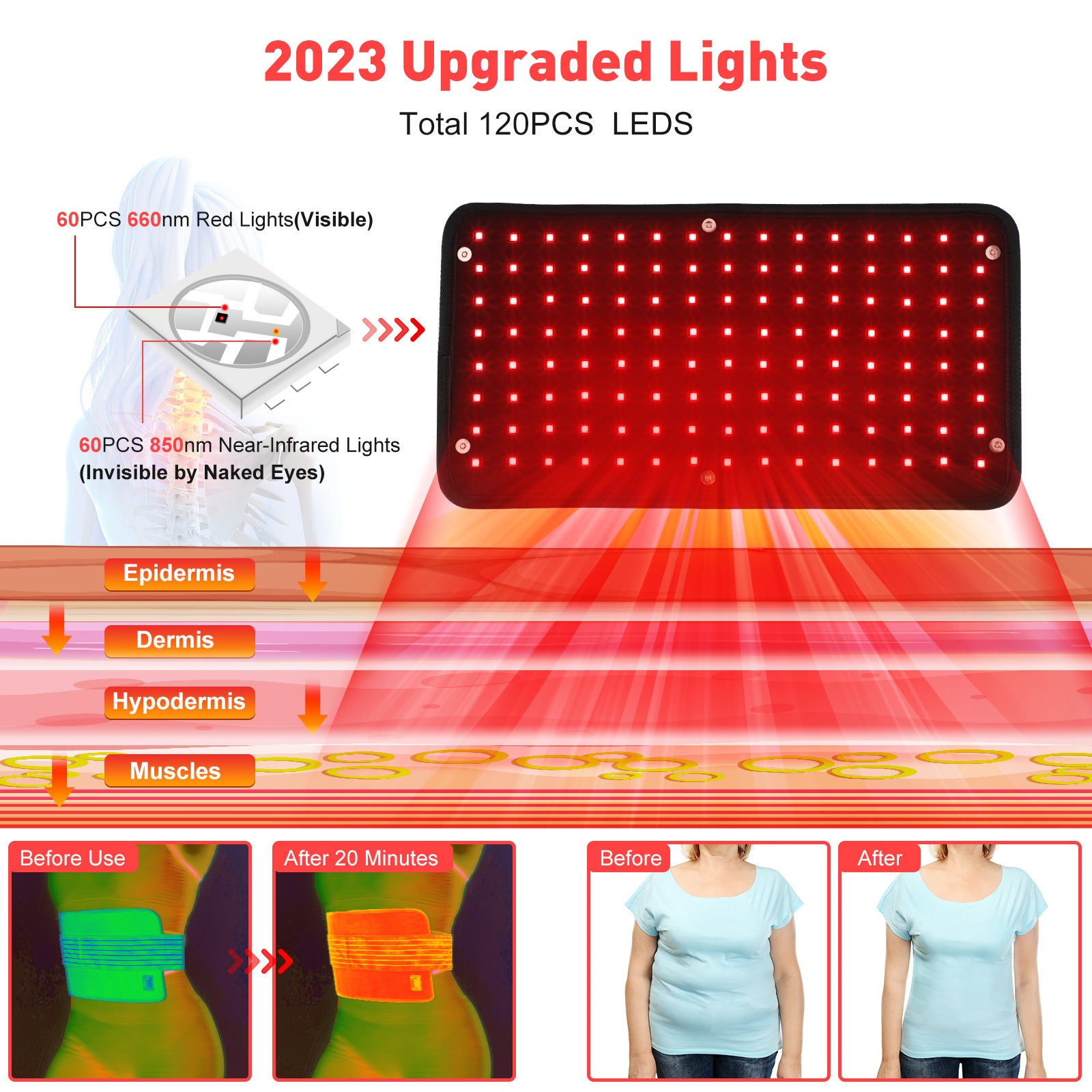 NovaSkin ThermaBelt